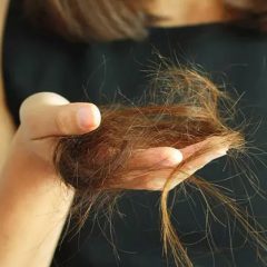 Из-за чего выпадают волосы на голове у девушек. Причины выпадения волос у женщин.